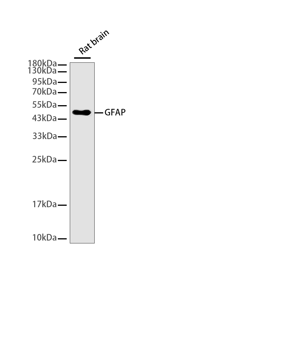 GFAP Rabbit mAb