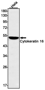 Cytokeratin 16 Rabbit mAb