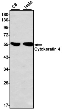 Cytokeratin 4 Rabbit mAb