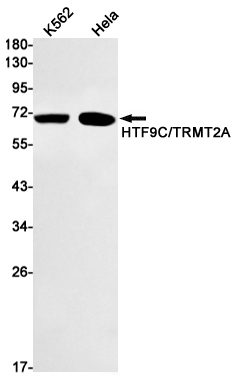 TRMT2A Rabbit mAb