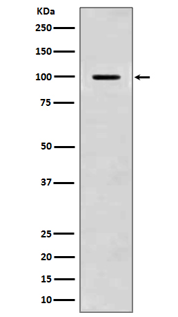 Amyloid beta A4  Rabbit mAb