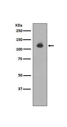 Neuropilin 1  Rabbit mAb