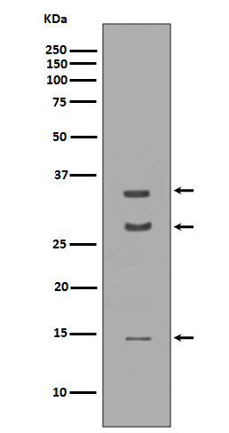 BDNF   Rabbit mAb